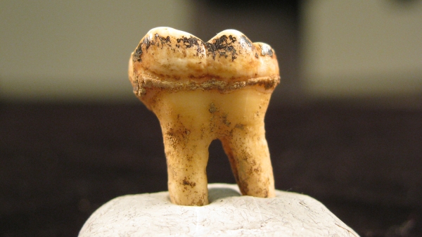chimpanzee tooth with dental plaque